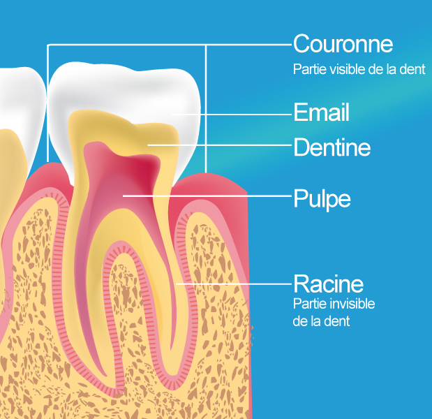 Dévitalisation - Traitement Endodontique à Nice