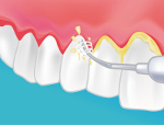 Dentiste Nice